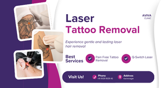Laser Tattoo Removal